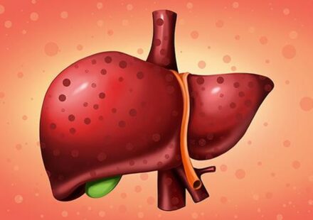 Ilustrasi pengidap hepatitis untuk artikel Kemenkes: 90% Pengidap Hepatitis Tidak Sadar