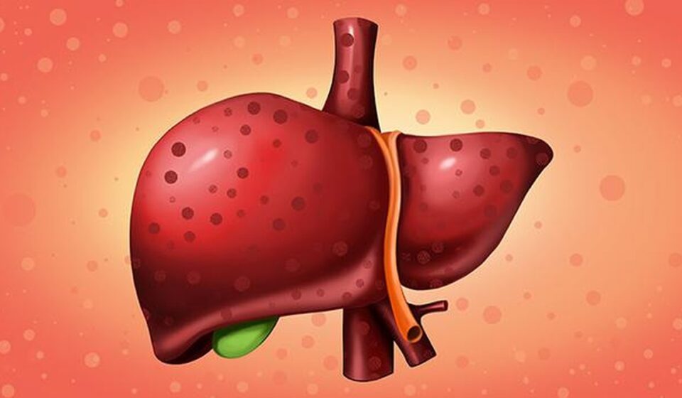 Ilustrasi pengidap hepatitis untuk artikel Kemenkes: 90% Pengidap Hepatitis Tidak Sadar